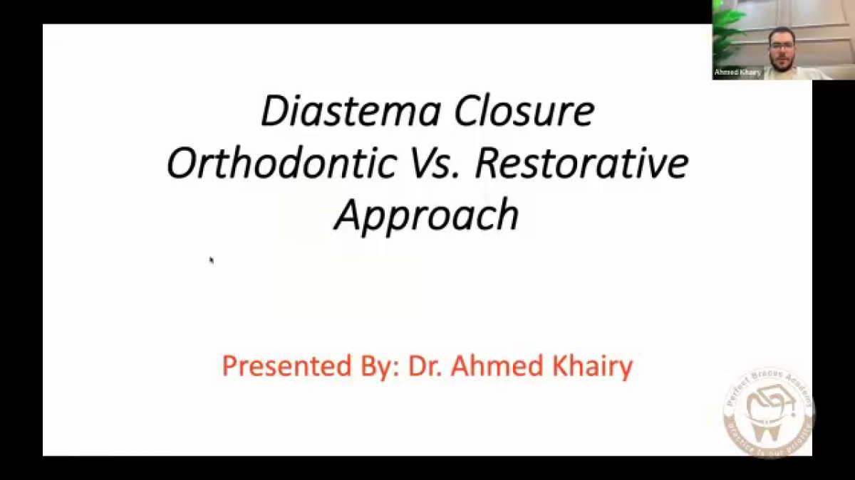 Diastema Closure: Orthodontic Approach Vs. Restorative Approach