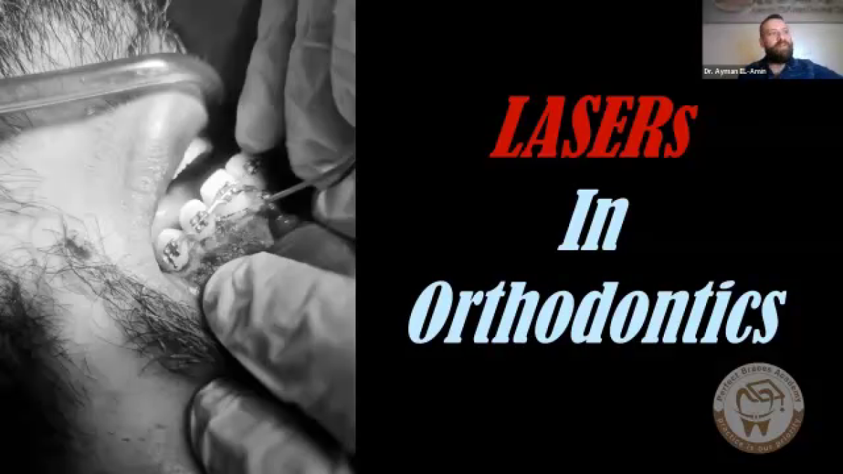 The Power of LASERs in Orthodontics: An Expert Perspective from Dr. Ayman AlAmin