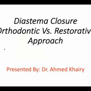 Diastema Closure: Orthodontic Approach Vs. Restorative Approach