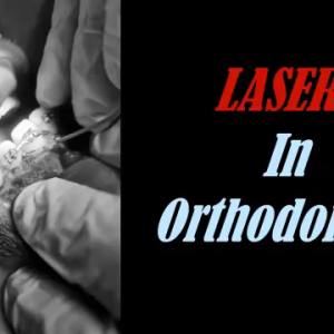 The Power of LASERs in Orthodontics: An Expert Perspective from Dr. Ayman AlAmin